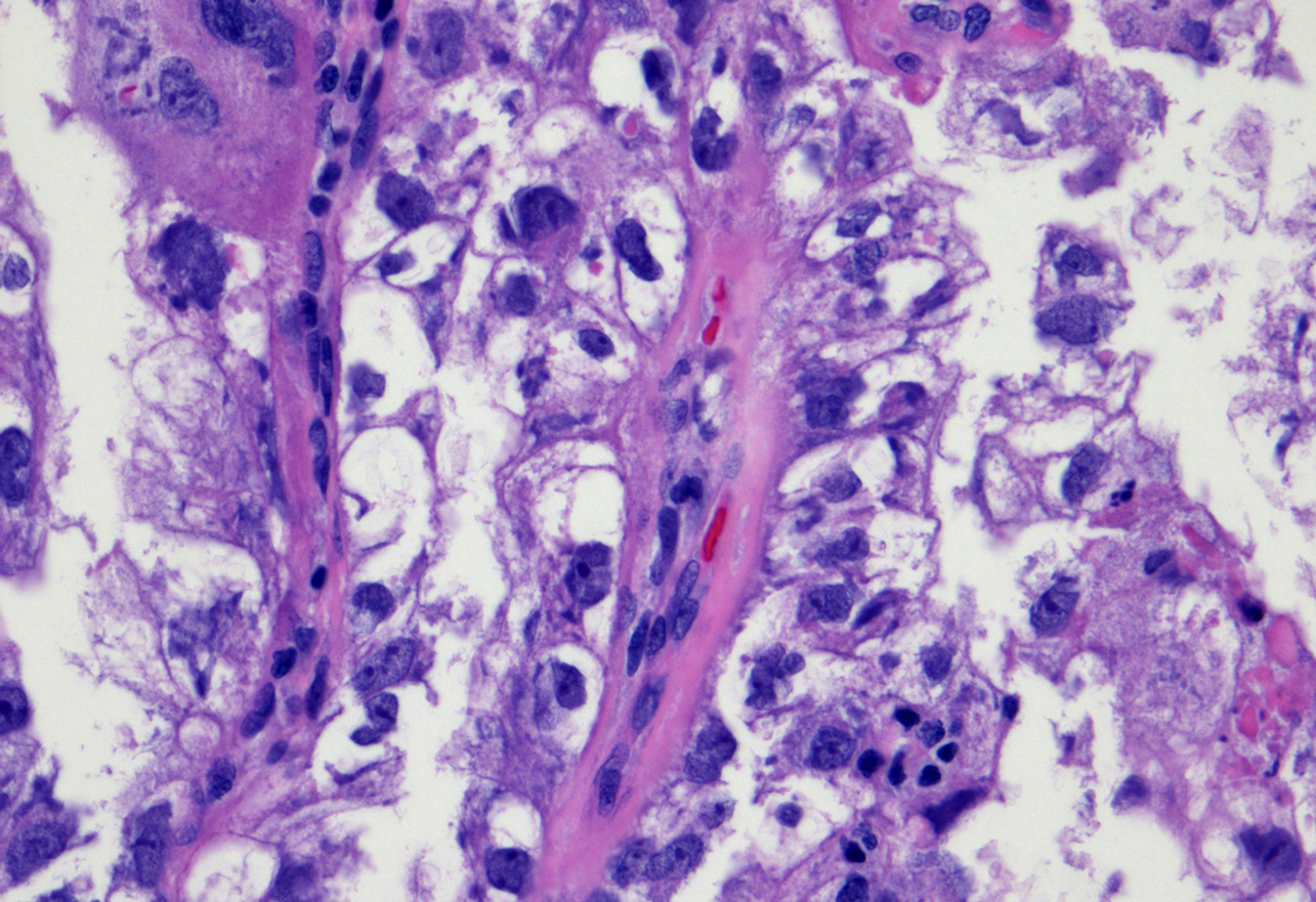 Anatomic Pathology Division