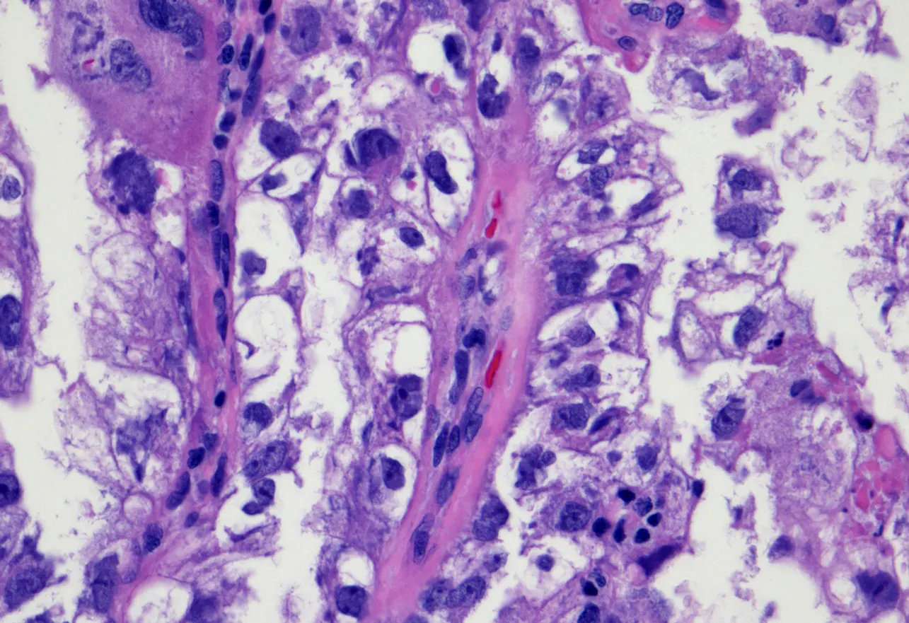 Anatomic Pathology Division