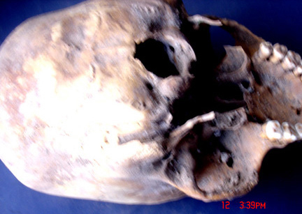 case-102