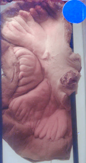 case-103