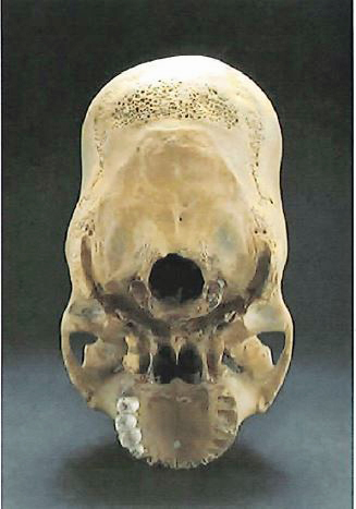 case-107a