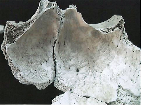 case-108a