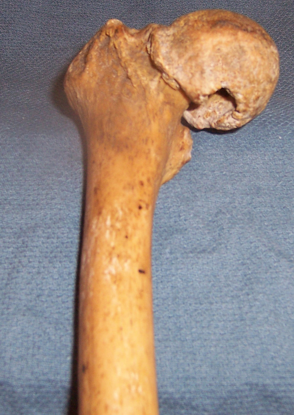 case-122