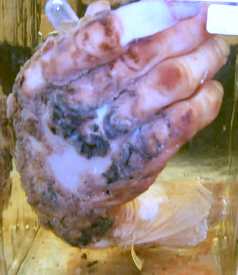 case111