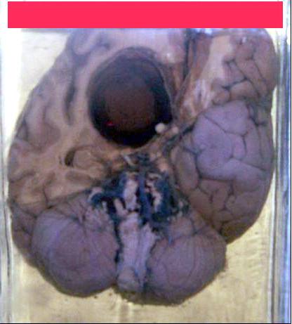 case115