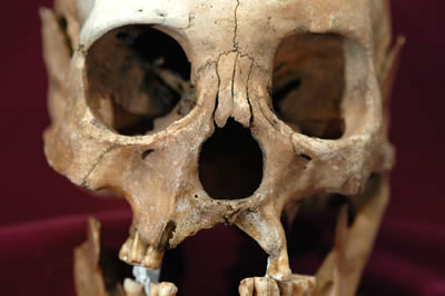 case116b