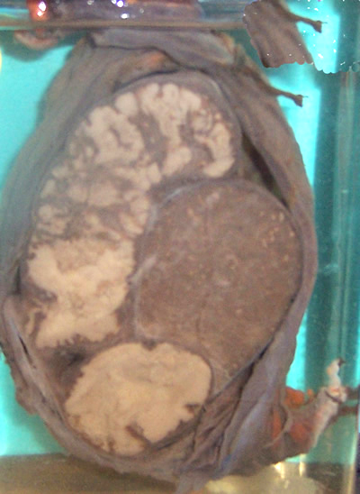 case117