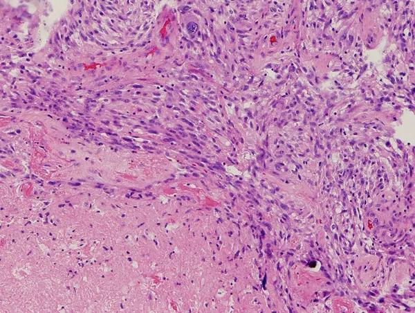 SURGICAL PATHOLOGY.
