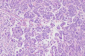 NEUROPATHOLOGY.