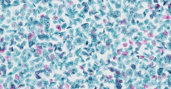 CYTOPATHOLOGY.