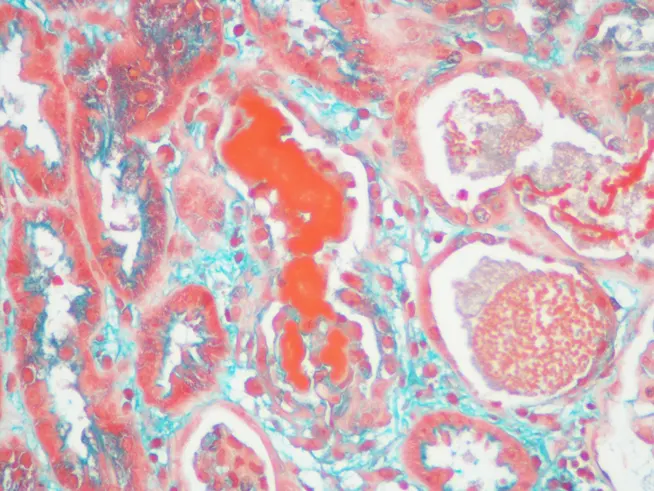 RENAL PATHOLOGY.